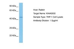 C22orf9 Rabbit anti-Human, Polyclonal, Novus Biologicals 0.1 mL | Buy Online | Novus Biologicals | Fisher Scientific